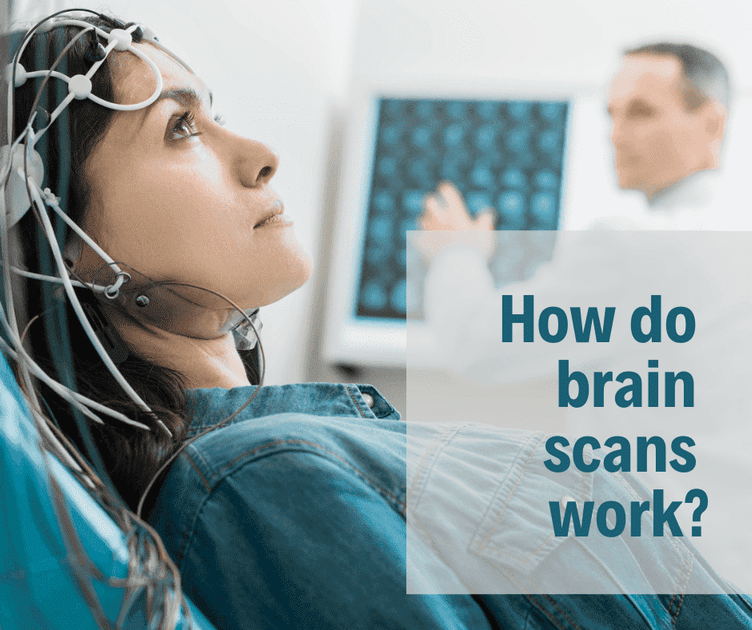 How do brain scans work? – Thumper Massager Inc. AU Store